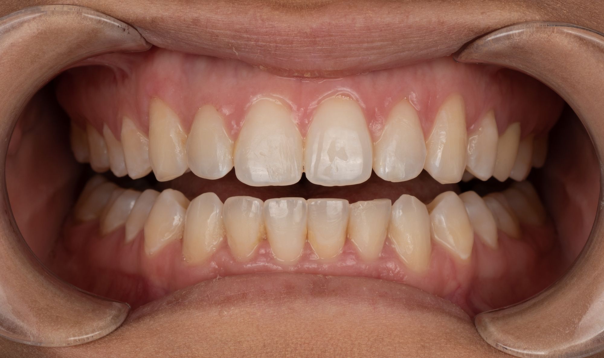 Jacksonville, FL Dentist JAX Dental Studio